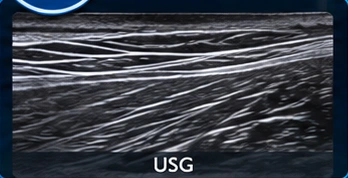 Muscles clinical illustration