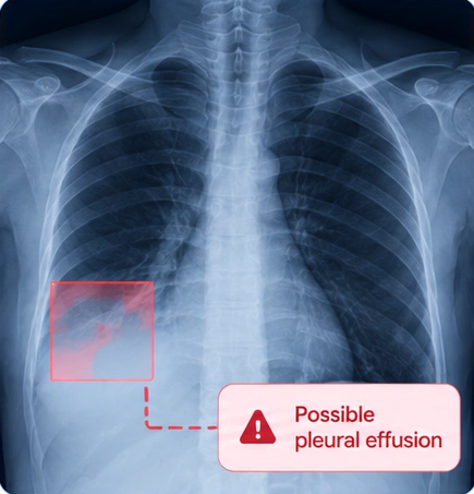 Cancer conceptual clinical illustration