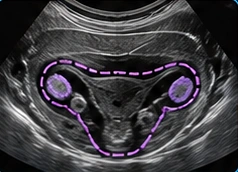 Pelvis USG clinical illustration